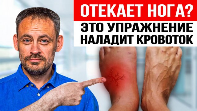 Почему отекает только ОДНА нога? 1 упражнение поможет наладить баланс кровообращения