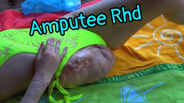 Amputee Rhd