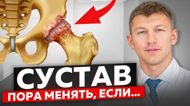 3 симптома, что пора на операцию по замене сустава / Проверь себя, пока еще не поздно!