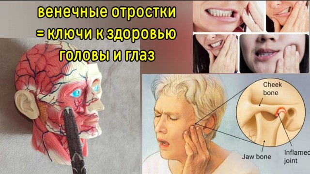Зрение и слух зависят от зажатых венечных отростков челюсти. Методы декомпрессии