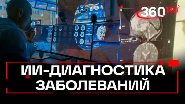 На страже неврологических заболеваний — искусственный интеллект: современная медицина