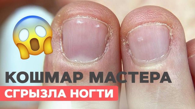 Что делать? Сложные ногти |Преображение обгрызенных ногтей