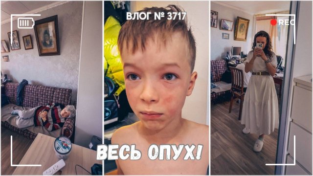 Аллергический отек на все лицо | Родительское собрание | Вот и бабушка!  -  ВЛОГ №3717 - 08.09.25