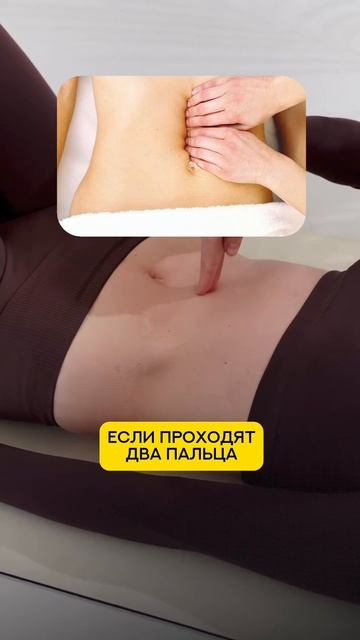 🤱 Диастаз есть у 100% женщин после родов