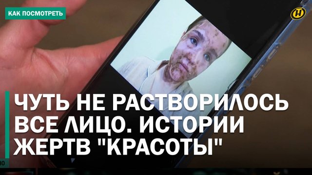 ЛИЦО ОСТАЛОСЬ НА ПОДУШКЕ. Можно ли доверять "экспертам" из Интернета? Истории жертв "красоты"