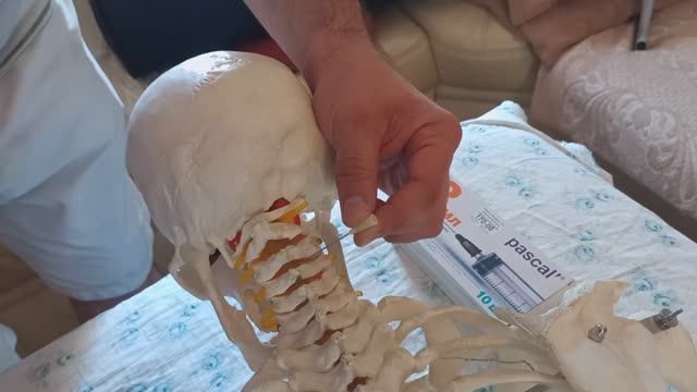 Как делать Блокады и Метод сухих игл. Тренинг у Олега Гудвина.