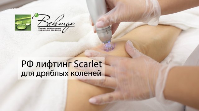 РФ лифтинг Scarlet для дряблых коленей: как вернуть упругость и молодость