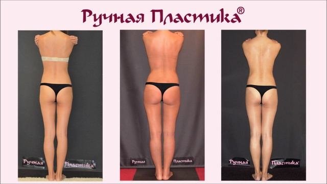 Ручная Пластика тела.  500 фото ДО и ПОСЛЕ. Центр  Ручная Пластика.