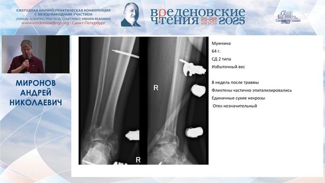 «Вреденовские чтения» 21.08.2025 - Зал A3-A5
