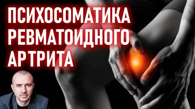 Какие ситуации приводят к ревматоидному артриту. Серопозитивный и серонегативный артрит