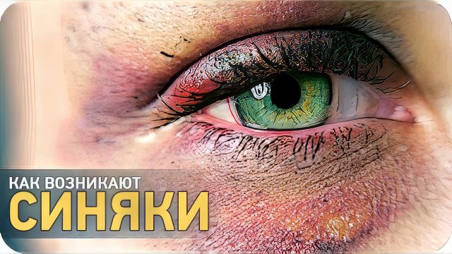 Как возникают синяки? [SLIVKI SHOW]