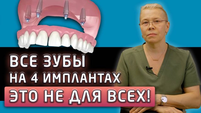 ПРО ЭТО МАЛО КТО ГОВОРИТ! Почему концепция все на 4 имплантах подходит не всем пациентам?