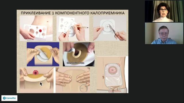 Вебинар 21.04.2020г. «Уход за стомой в условиях самоизоляции»