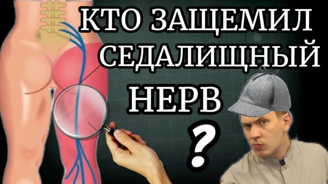 Разблокировка защемлённого седалищного нерва при острой боли / в 90 % случаев виновата ...