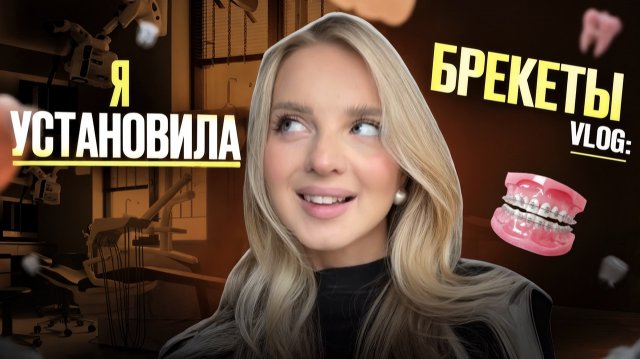 VLOG: установка брекетов | первые ощущения , что важно знать