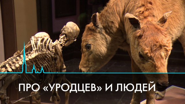 Про «уродцев» и людей. Куда пропала анатомическая коллекция Кунсткамеры?