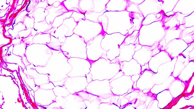 Мезенхимальные и меланоцитарные опухоли. Опухоли нервной системы, герминоклеточные опухоли