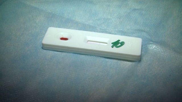 Пресс-конференцию по профилактике и борьбе со СПИДом проводят в Вологде