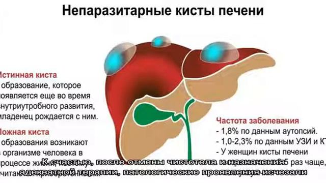Эффективные способы лечения кисты печени