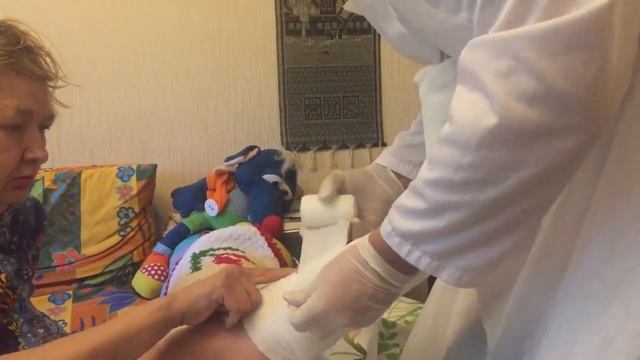 Наложение пластикового гипса на ногу