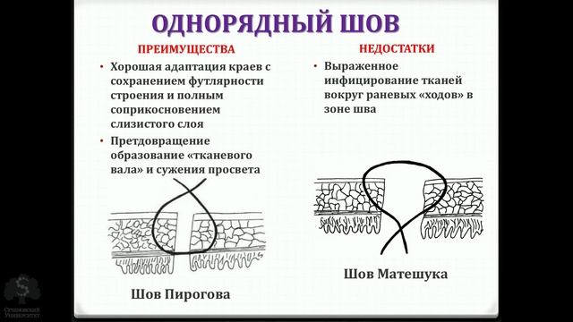 Кишечные анастомозы