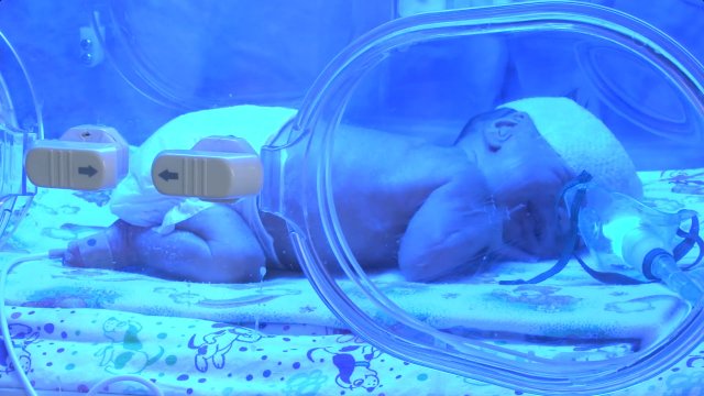 Как выхаживают недоношенных детей в перинатальном центре