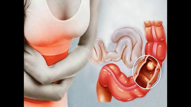 Старинное народное средство от запора