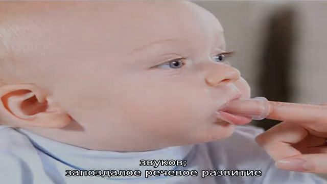 Что такое ринолалия и как лечить заболевание?