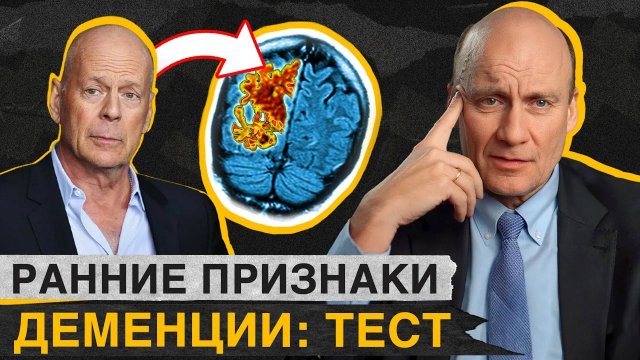 Как ОБЕЗОПАСИТЬ себя от ДЕМЕНЦИИ? / Тест на деменцию