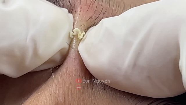 Satisfying and Relaxation with SURI NGUYEN Beauty Spa Video #293