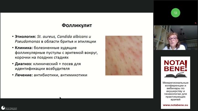 Эпиляция интимной зоны: косметический тренд и медицинский риск. Лекция для врачей. NOTA BENE! СПб