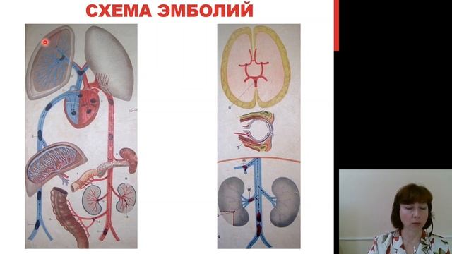 Патологическая анатомия 2.Расстройства кровообращения