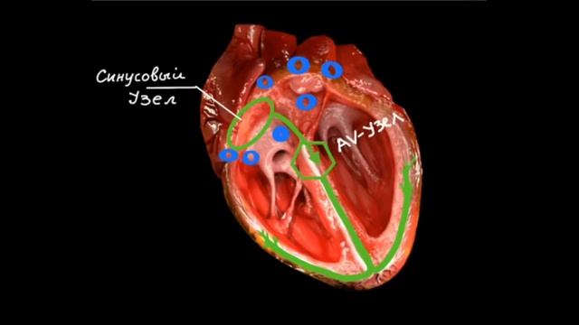 ПАРОКСИЗМАЛЬНАЯ ФИБРИЛЛЯЦИЯ ПРЕДСЕРДИЙ