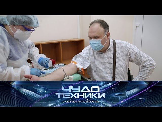 "Чудо техники": экспресс-тесты на антитела к COVID-19 и "карманный" велосипед (17.05.2020)