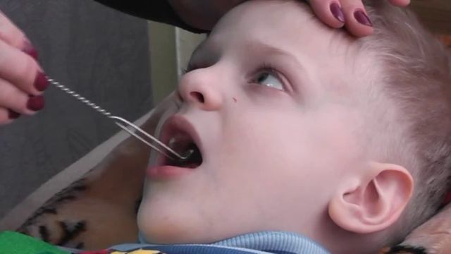 Логопедия. Мастер-класс по зондовому массажу для детей с недоразвитием речи