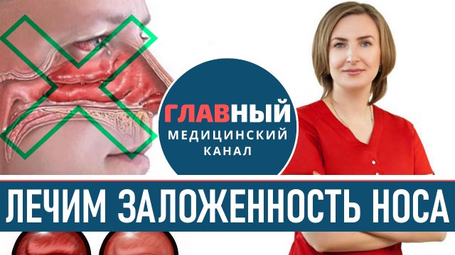 Лечение вазомоторного ринита. Как лечить заложенность носа без насморка