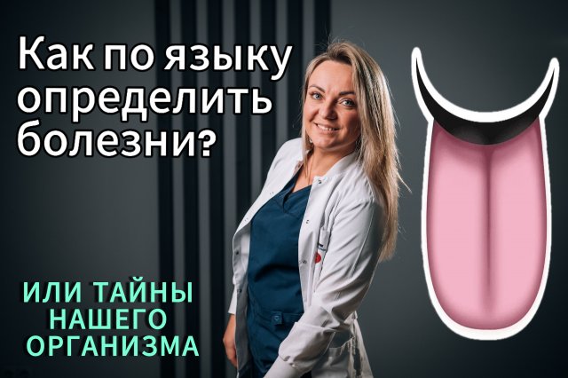 Язык как карта внутренних заболеваний!