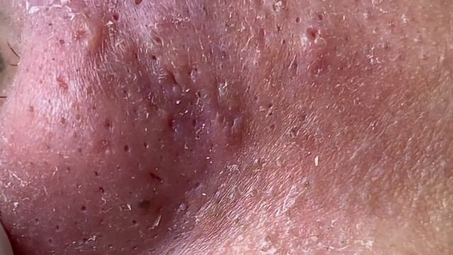 Satisfying Relaxing Best Video with Win Spa #118