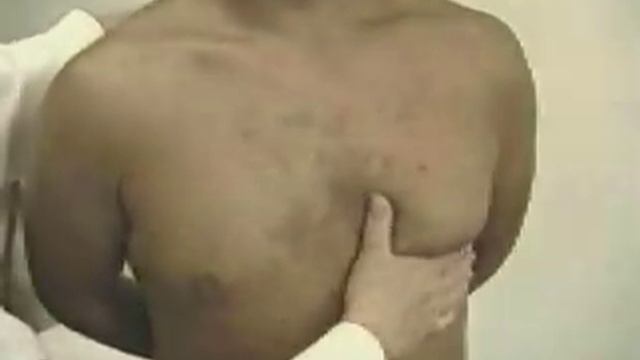 apical. верхушечный толчок