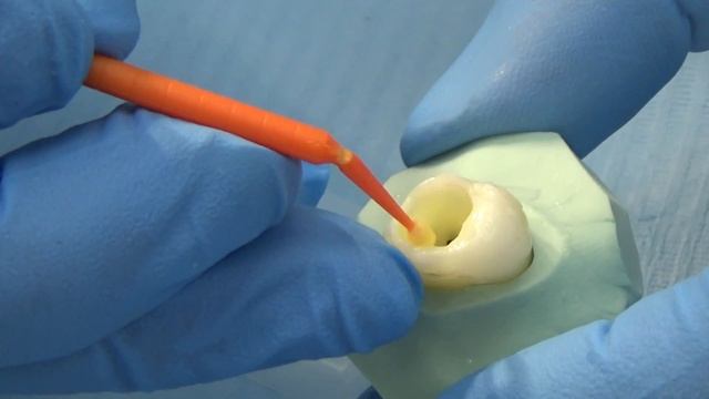 часть 2 . Universal адгезивные системы . Техника селективная и самопротравливания