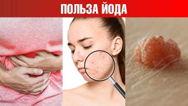 Как определить дефицит йода дома? 🧐 Польза йода