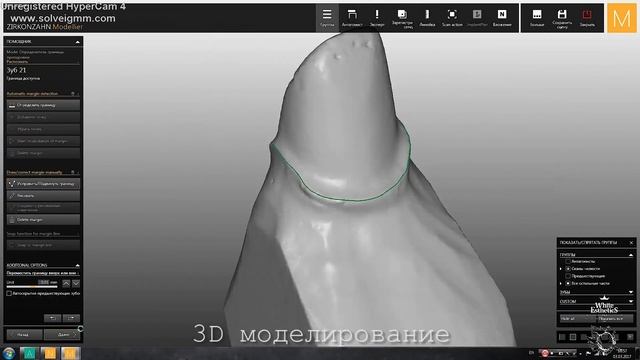 Что такое цифровая стоматология?