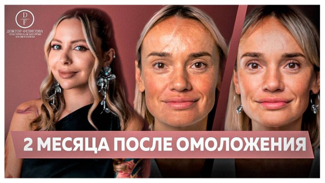 2 МЕСЯЦА ПОСЛЕ ОМОЛОЖЕНИЯ