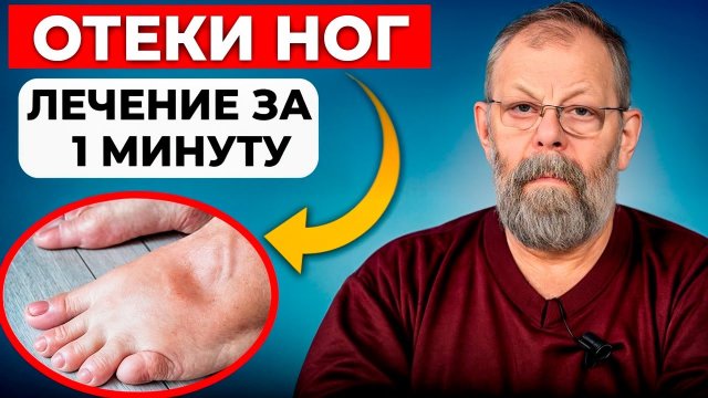 Отеки, вены, трудно дышать 1 упражнение поможет за 1 минуту