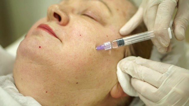 Meso Wharton (Мезовартон).