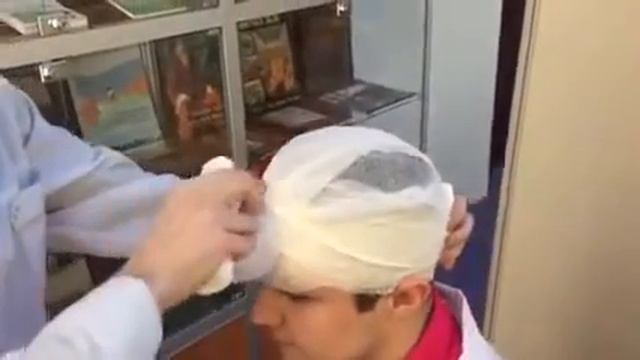 Повязка «Шапочка Гиппократа» двумя бинтами