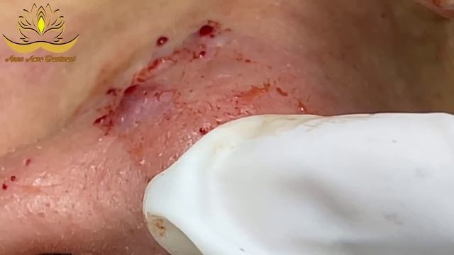 Most Satisfying and Relaxation with An Spa Video #095