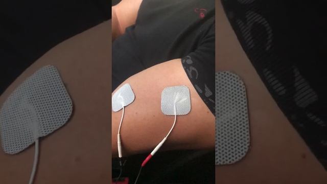 Миостимулятор «Меркурий»