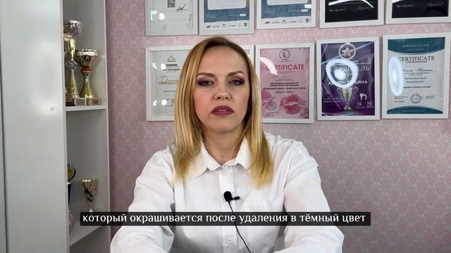 Лазер или ремувер? Что лучше для удаления татуажа?