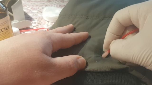 Удаление монтажной пены с одежды.